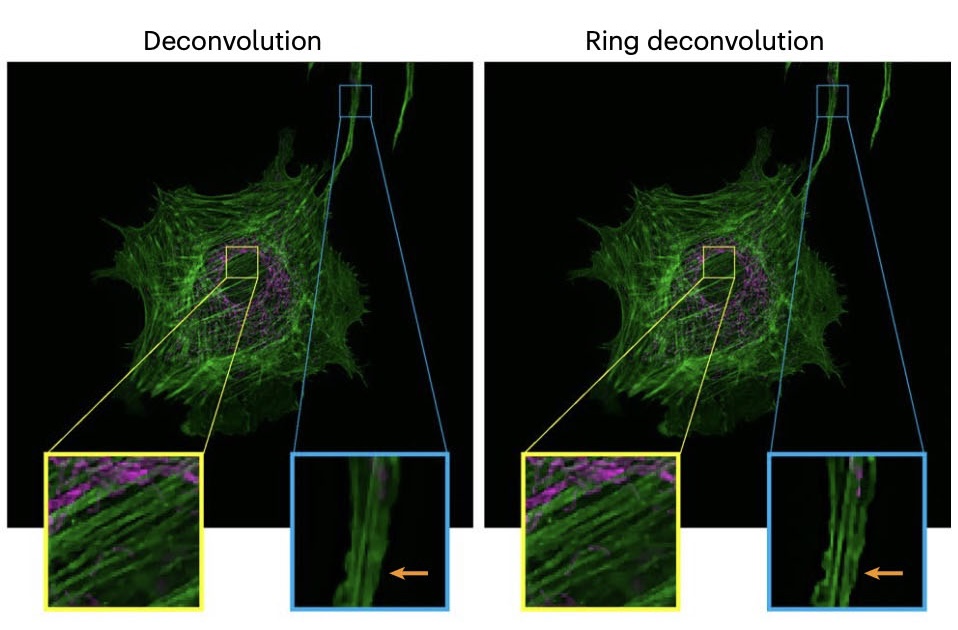 Ring Deconvolution Microscopy result